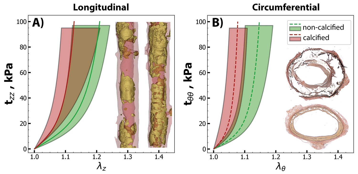 Vergleich von Gefäßelastizität: Diagramme und Querschnitte zeigen Unterschiede zwischen verkalkten und nicht verkalkten Arterien.
