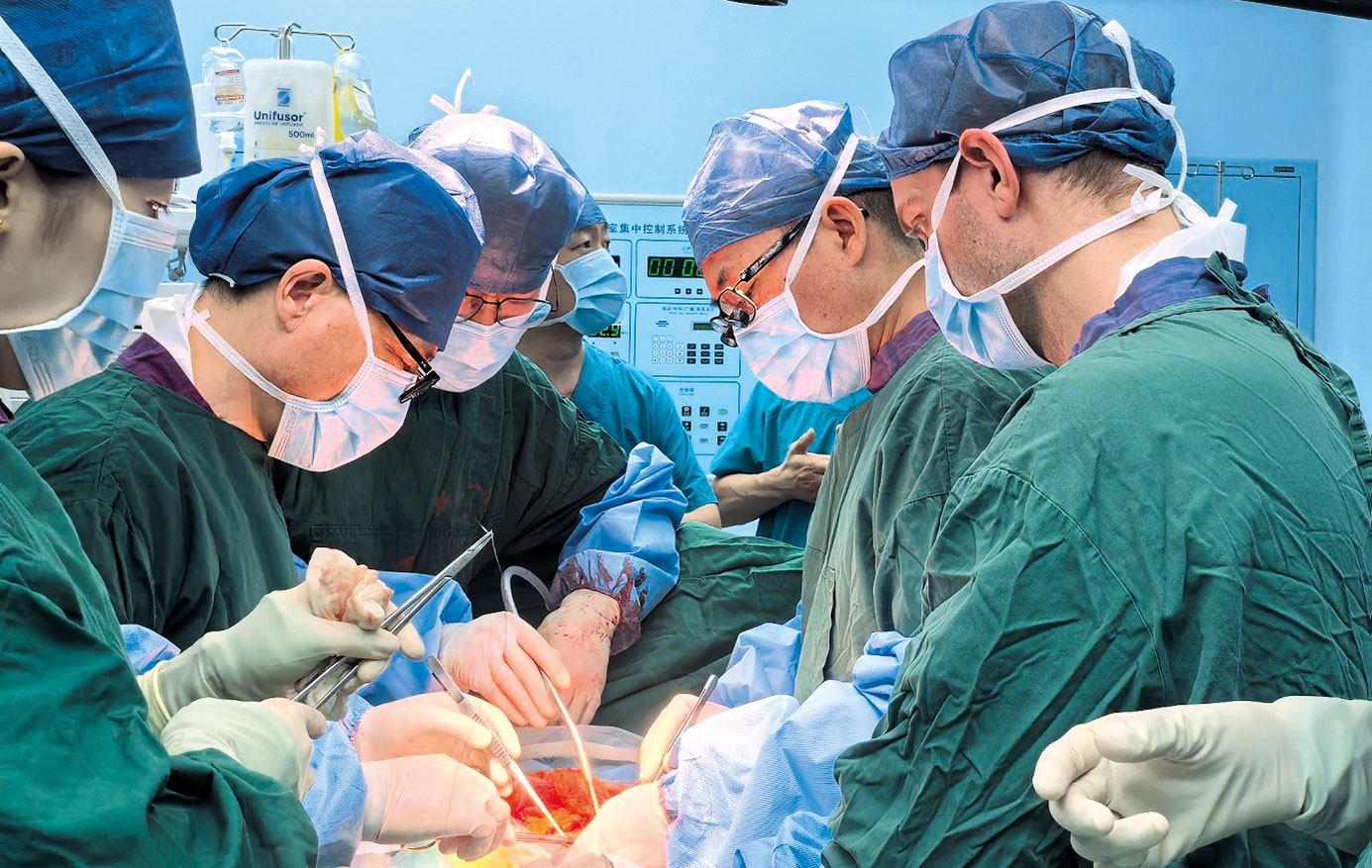 Chirurgenteam führt komplexe Operation im OP-Saal durch – Fokus auf präziser Zusammenarbeit und Teamarbeit.