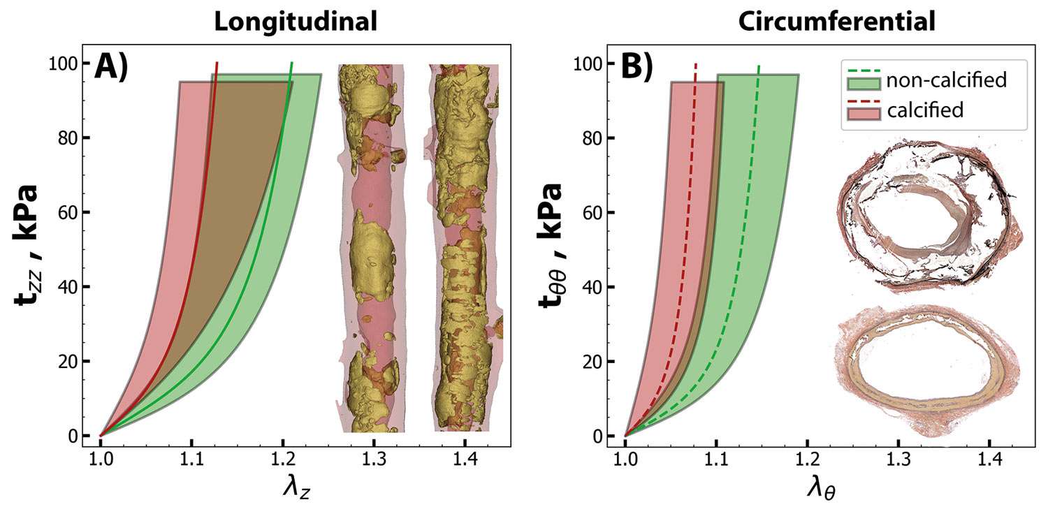 Vergleich von Gefäßelastizität: Diagramme und Querschnitte zeigen Unterschiede zwischen verkalkten und nicht verkalkten Arterien.